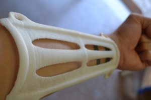 Archery arm guard