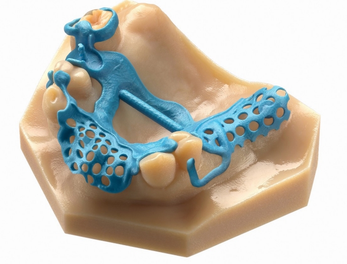 Servizio stampa 3D odontoiatria
