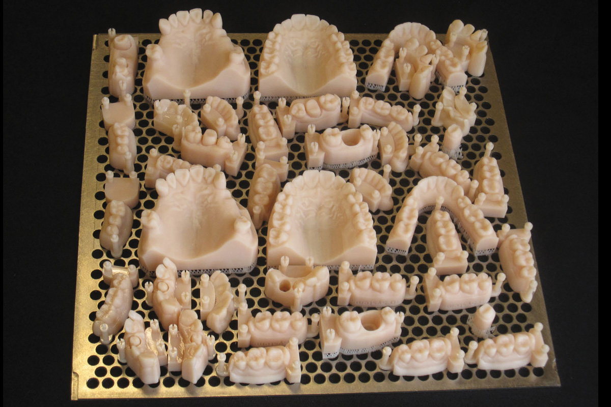 Arcata dentale stampata in 3D
