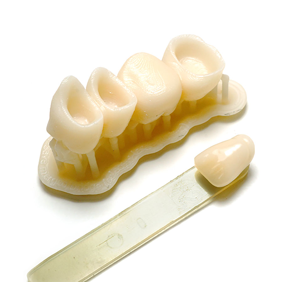Dente stampato in 3D
